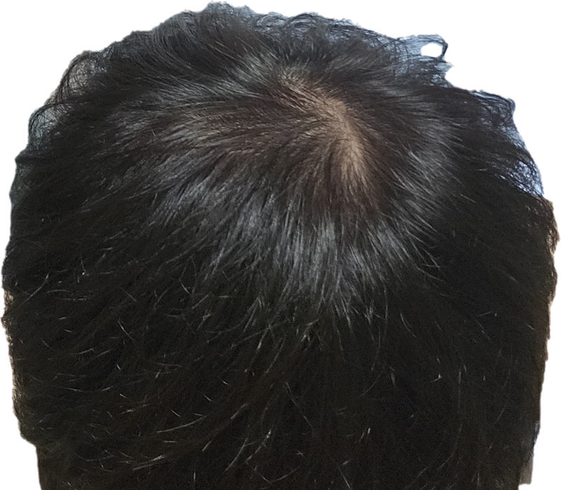 1000039256.png