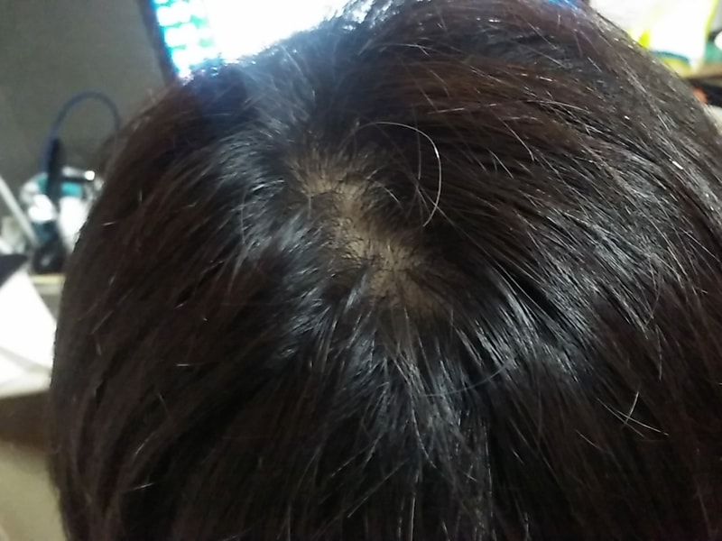20170428_221635.jpg