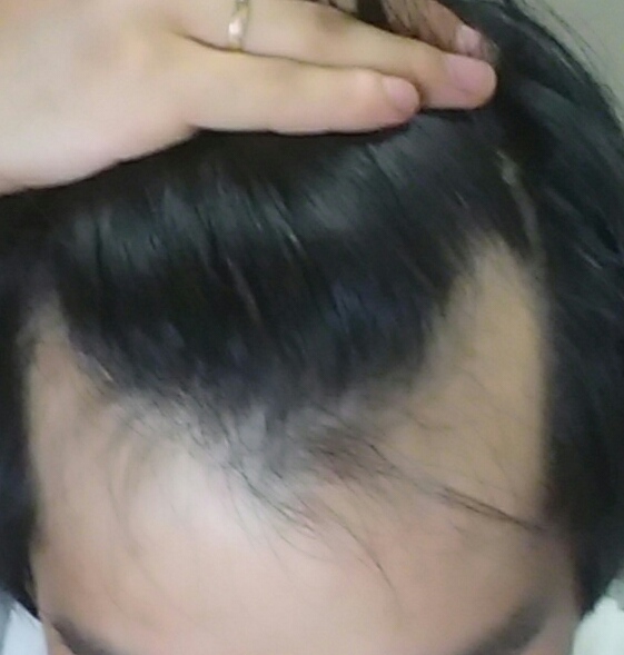 CROP_20150921_234212.JPG