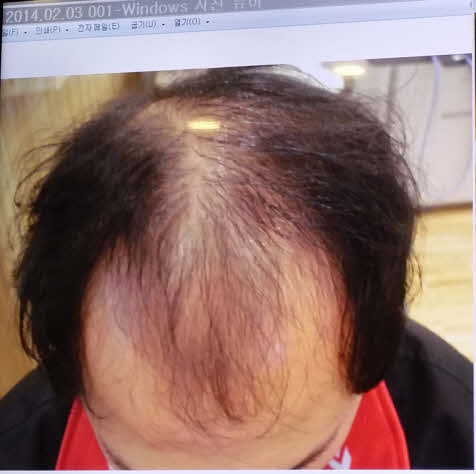 치료전 사진.jpg