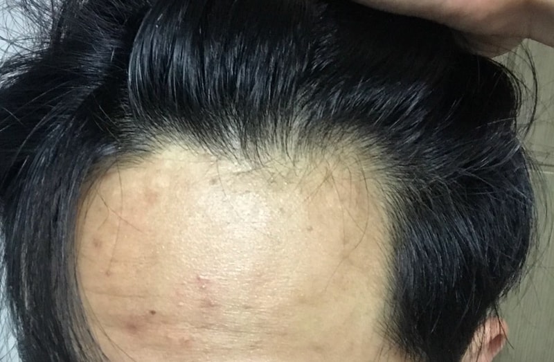 KakaoTalk_20180505_034637427.jpg
