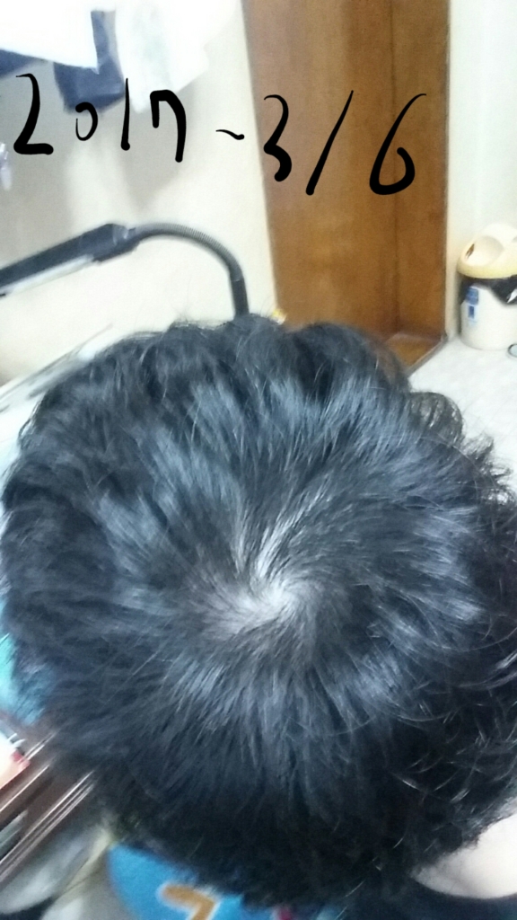 20170306_085810.jpg