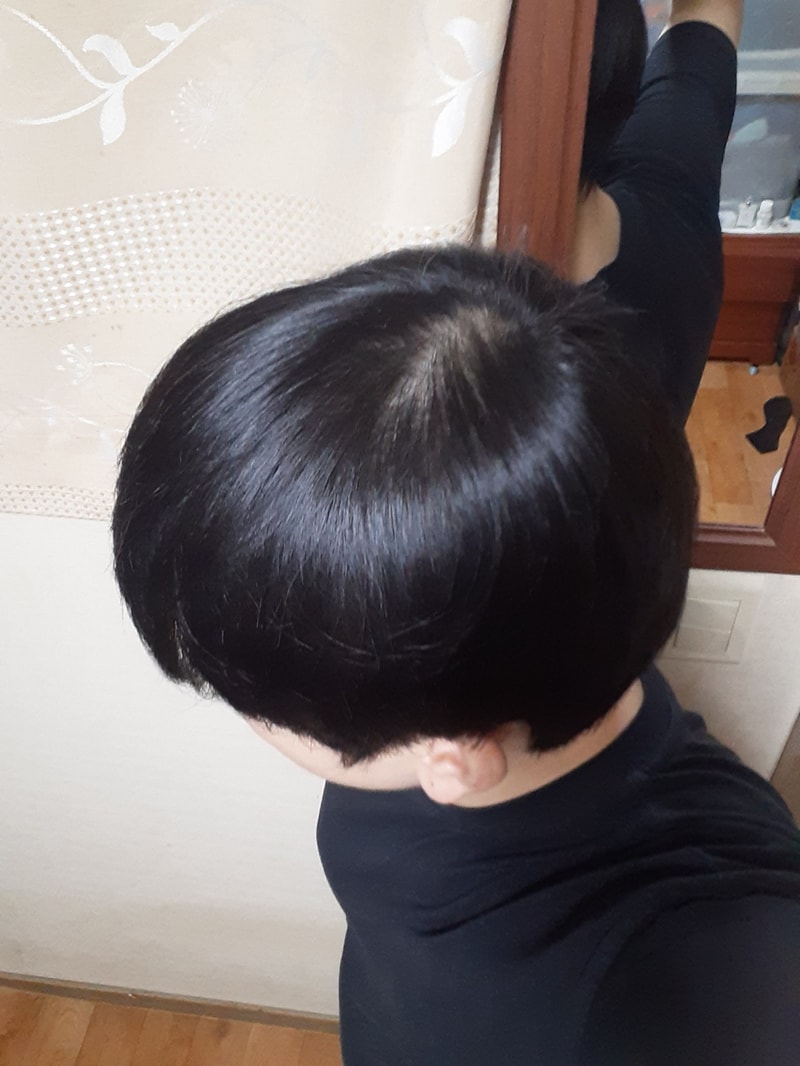 열심히 살아도 탈모는 참..