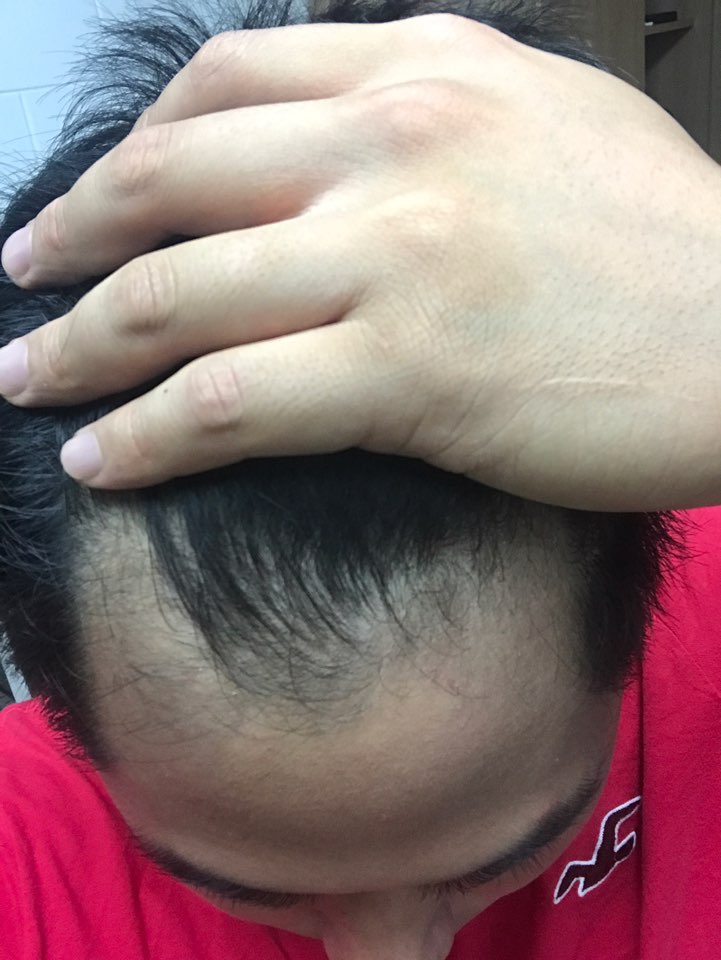 KakaoTalk_20170801_192216223.jpg