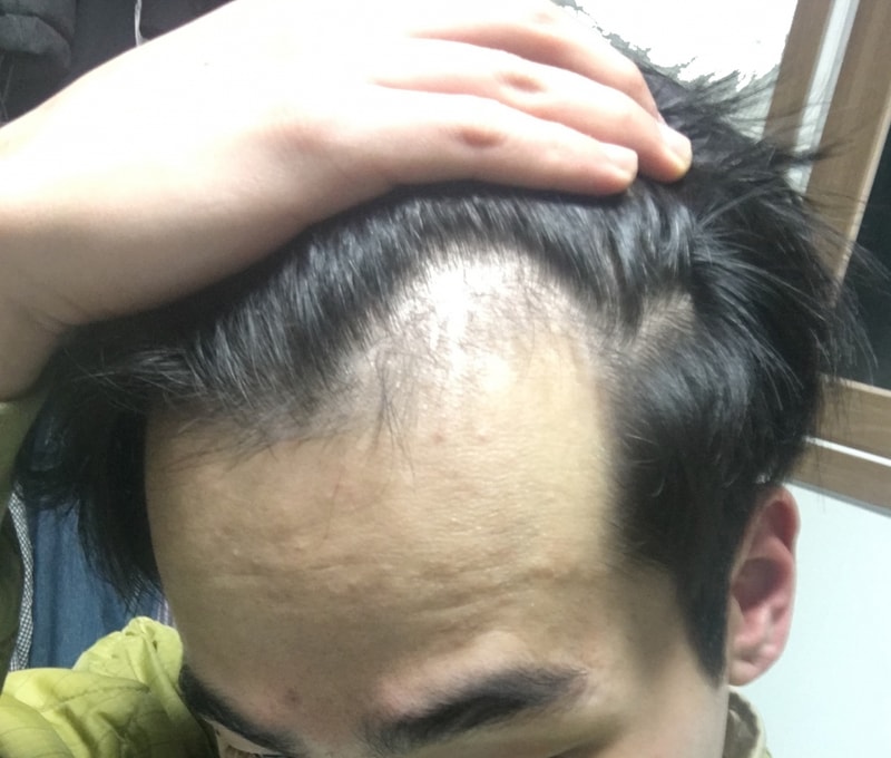 좌측.jpg