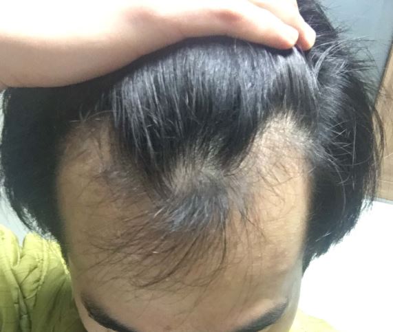 윗면.jpg
