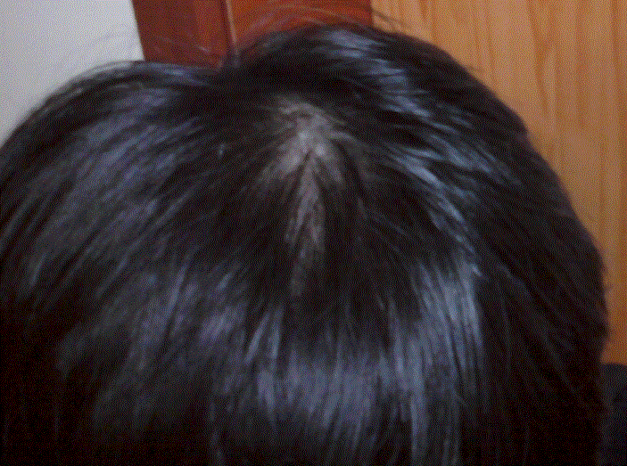 7.GIF