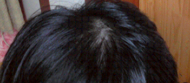 3.GIF