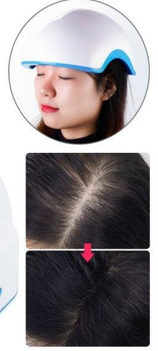 치료기.PNG