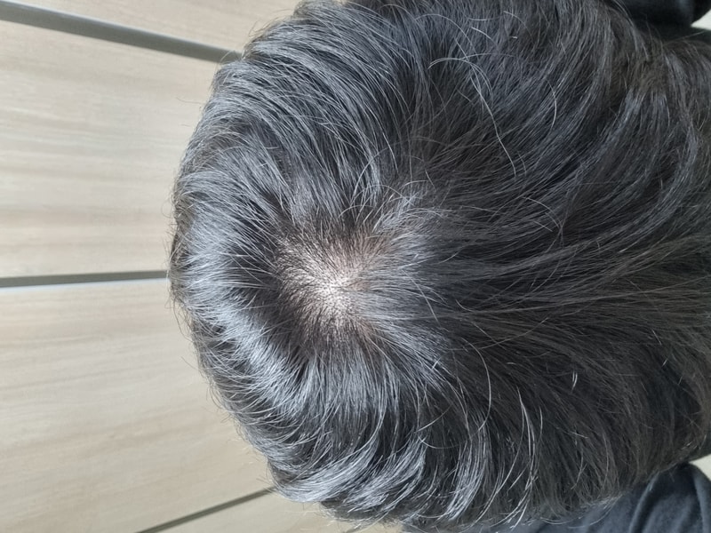 정수리 사진.jpg