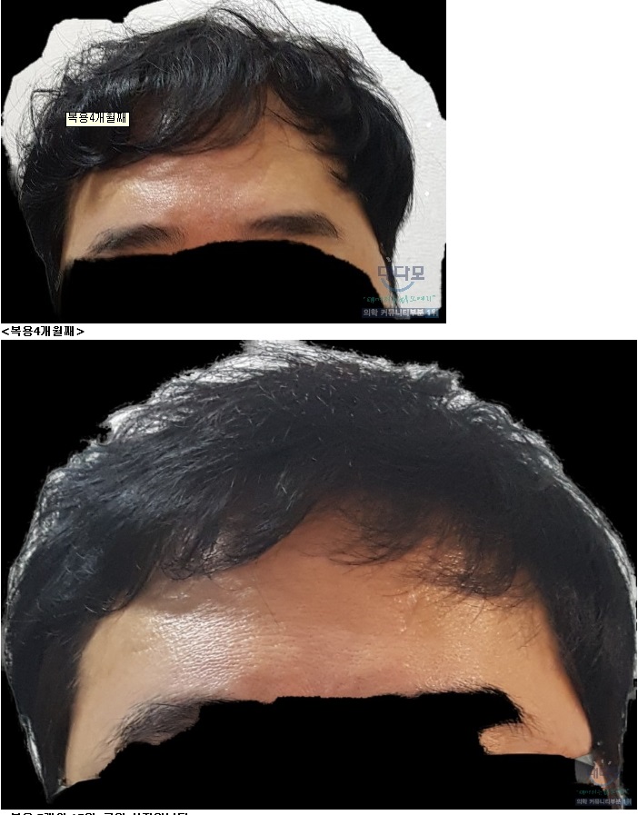 44.jpg