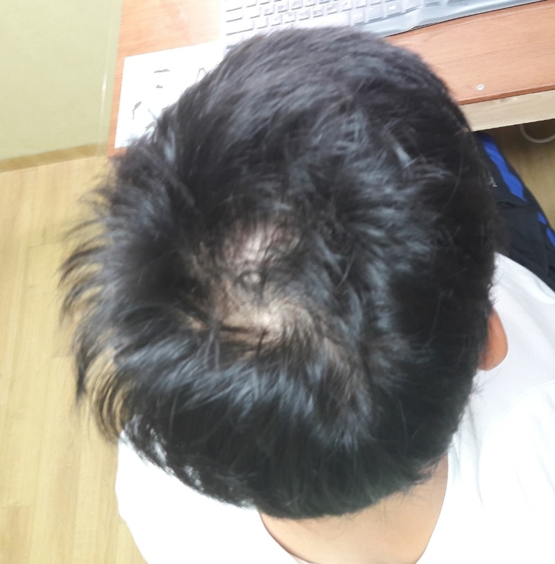 KakaoTalk_20170809_215248435.jpg