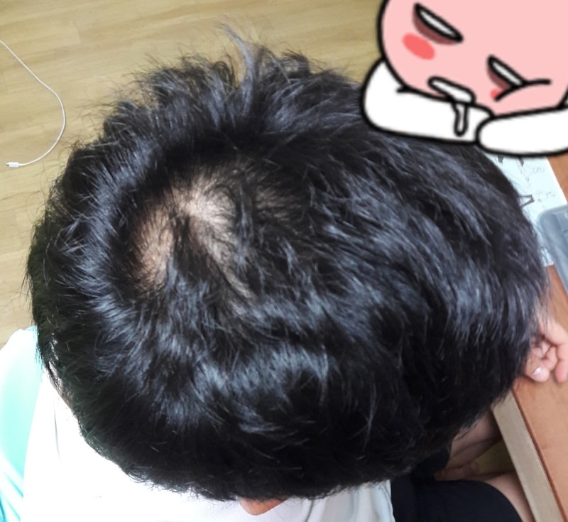 KakaoTalk_20170809_215247642.jpg