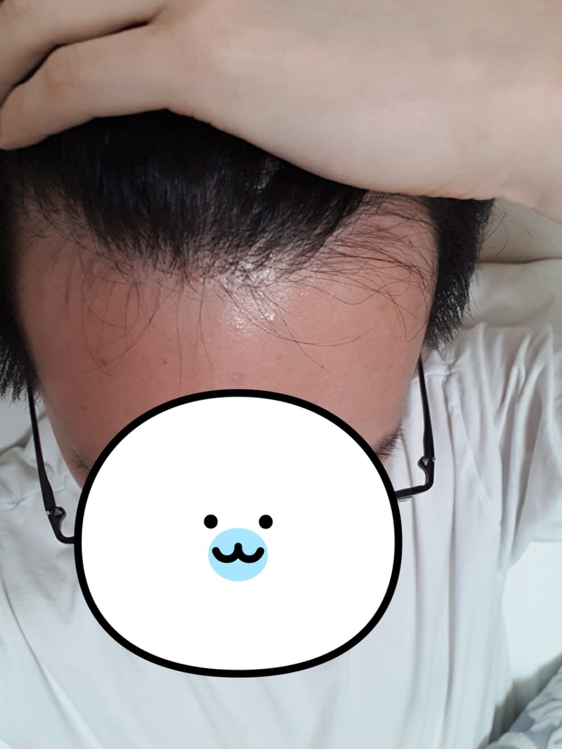 샴푸 바꾸고 나서 머리가 엄청 얇아지고 부드러워졌네요 ㅠ