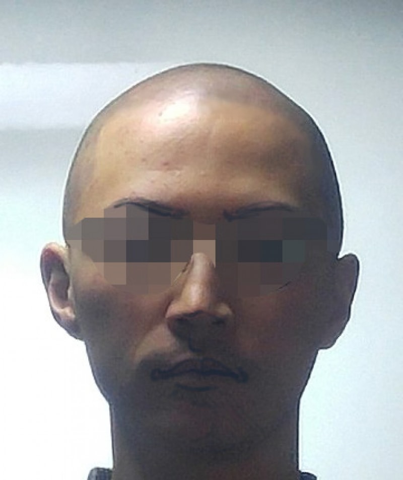 이마2.jpg