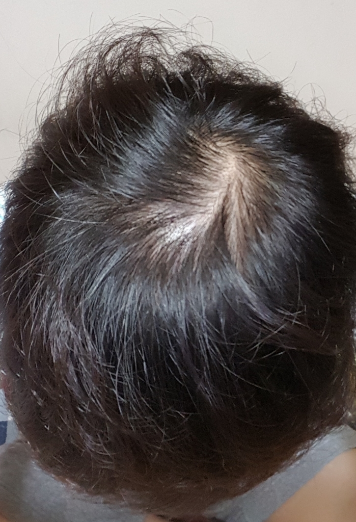 20180302_184918.jpg
