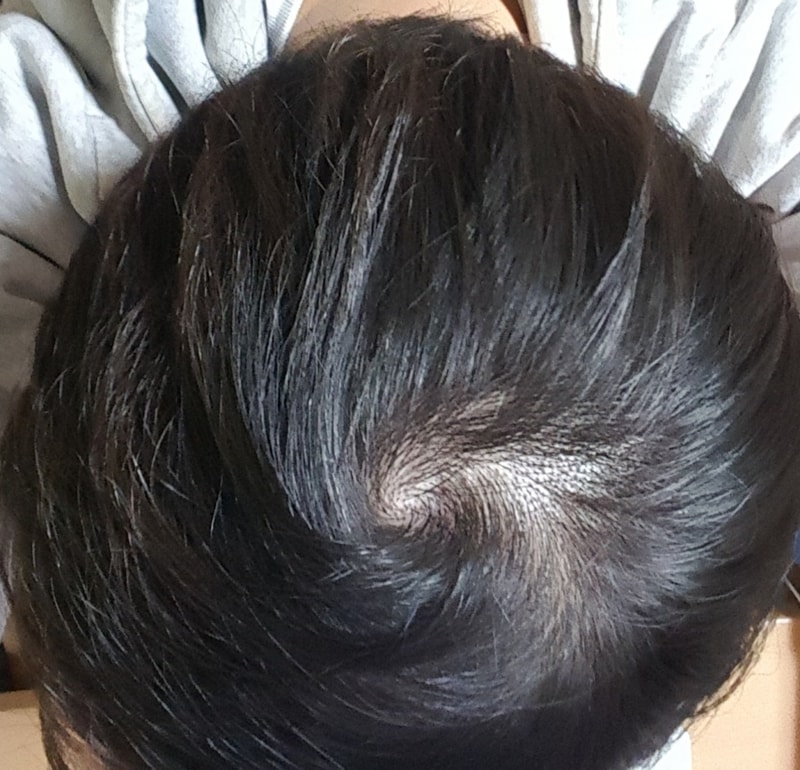 20180302_185003.jpg