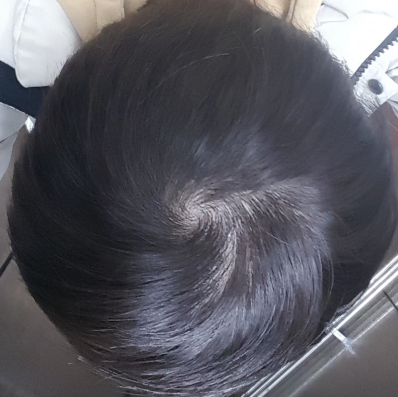 20180302_185050.jpg