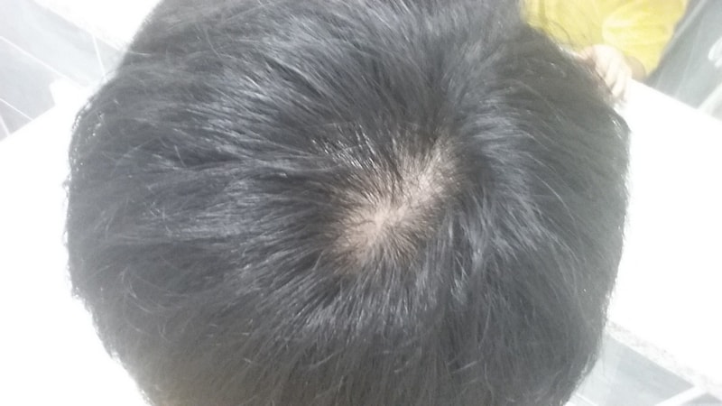 20180827_111451.jpg