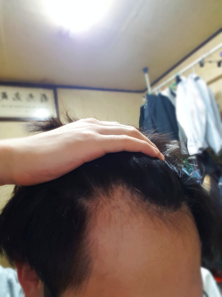 왼쪽.jpg