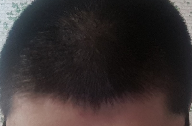 20180331_122352.jpg