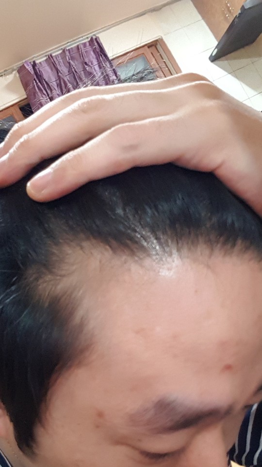 KakaoTalk_20170821_144342021.jpg