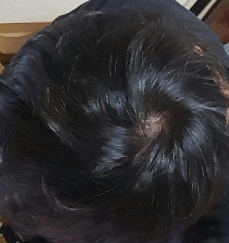 20161121_015739.jpg