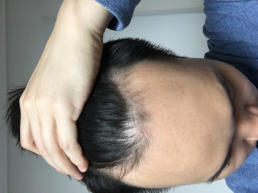 수술 전날 밤