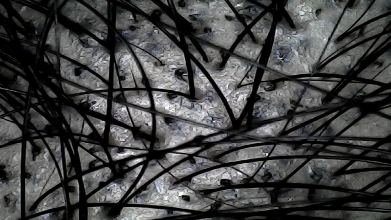 정수리1.jpg