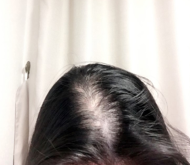 KakaoTalk_20170807_211452190.jpg