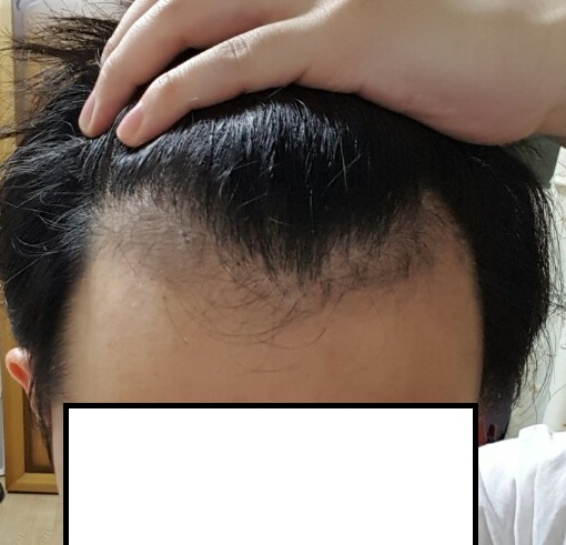 KakaoTalk_20170222_211055452.jpg