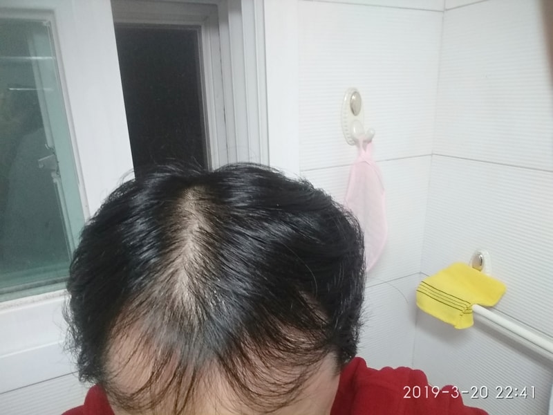 IMG_20190320_머리감은지2일후.jpg
