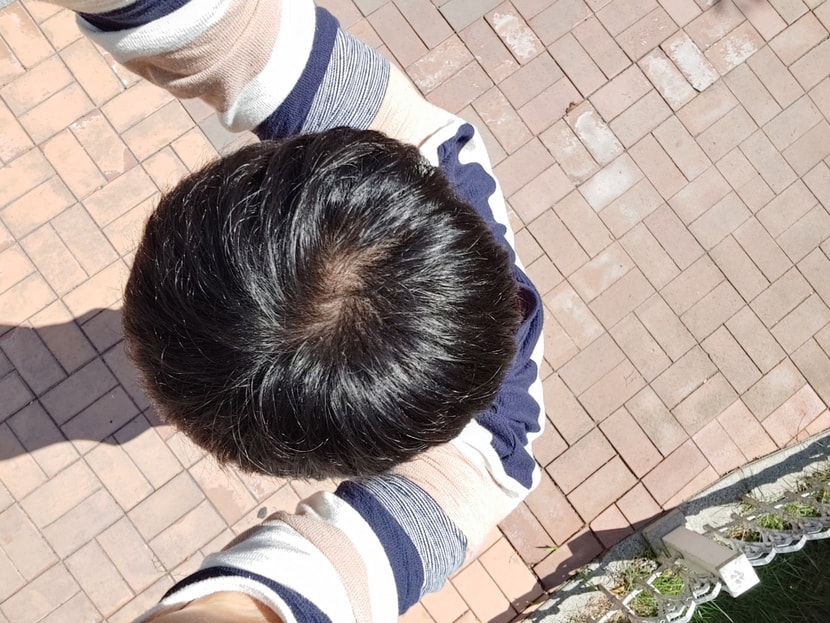 바깥 햇빛