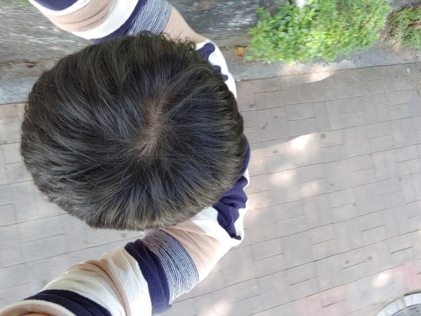 바깥 그늘 머리 정돈 후
