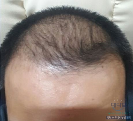 12월 10일경.JPG