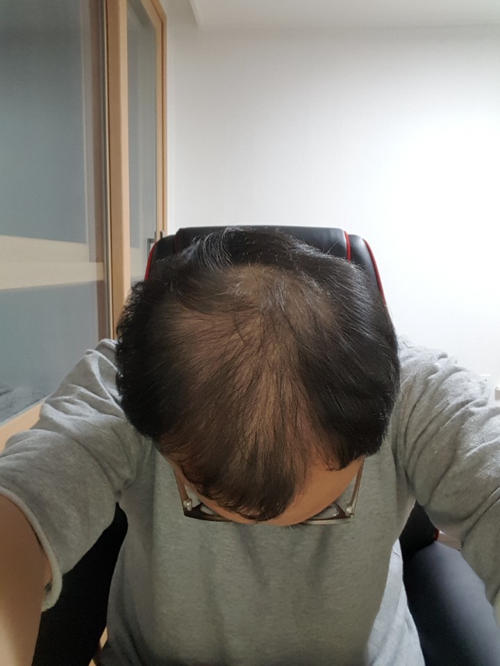 KakaoTalk_20170707_221526669.jpg
