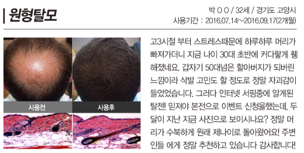 탈젠.png