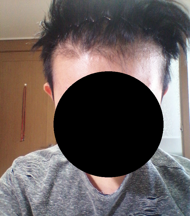 앞머리.png