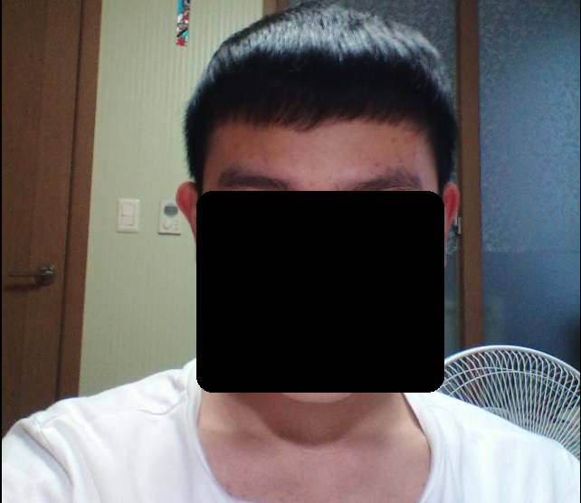 약복용전 앞머리있음.png