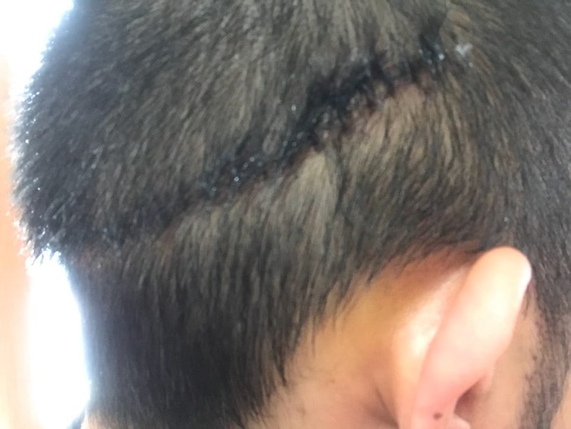 KakaoTalk_20180617_144041212.jpg