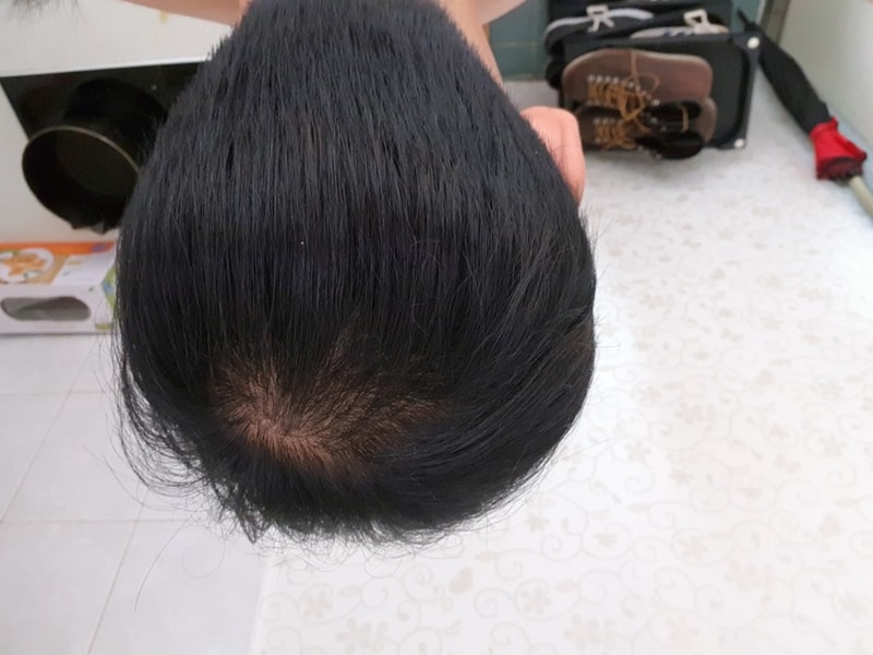 20170825_113754.jpg