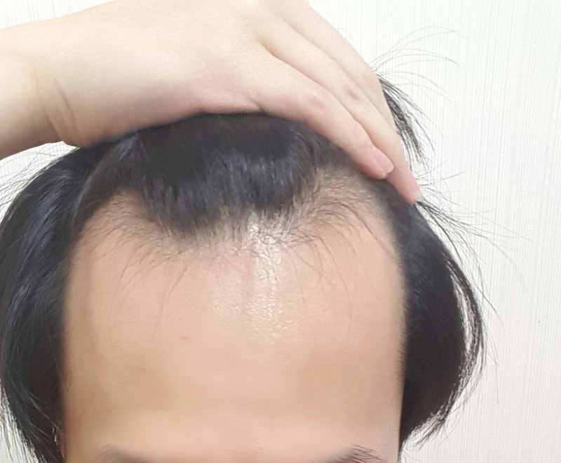 20170403_184931.jpg