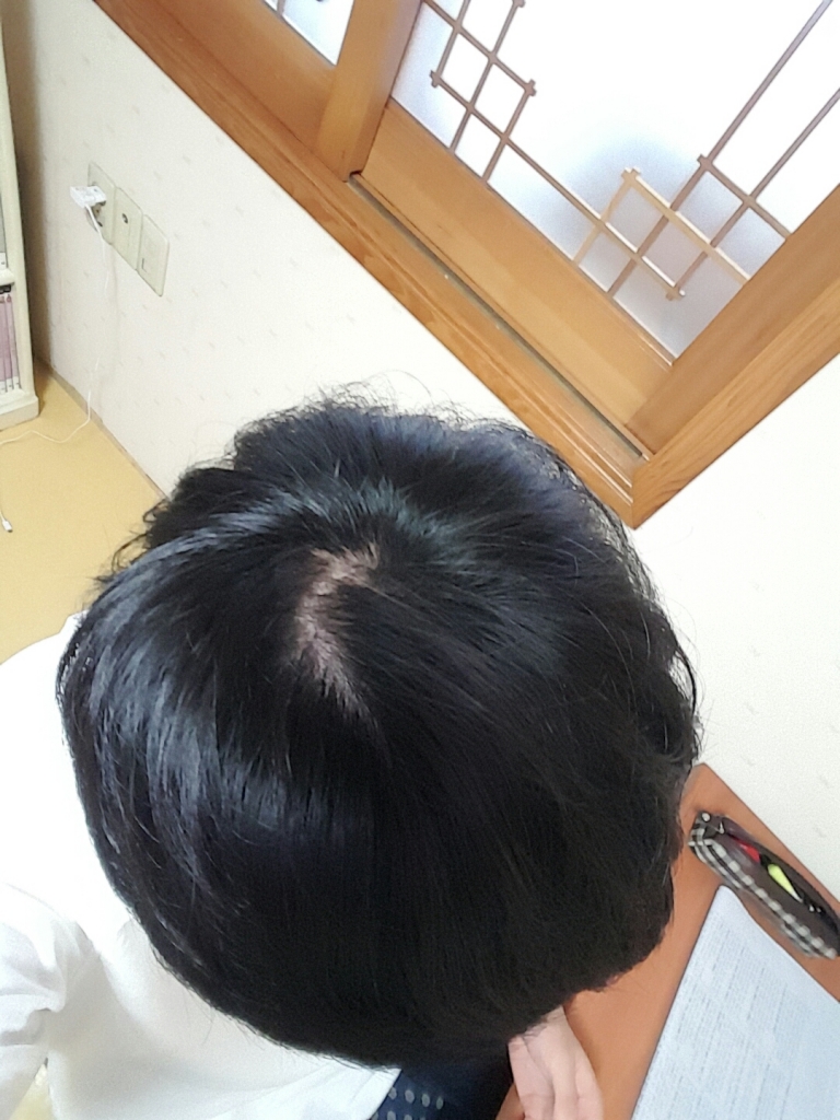 B612_20170422_163352.jpg