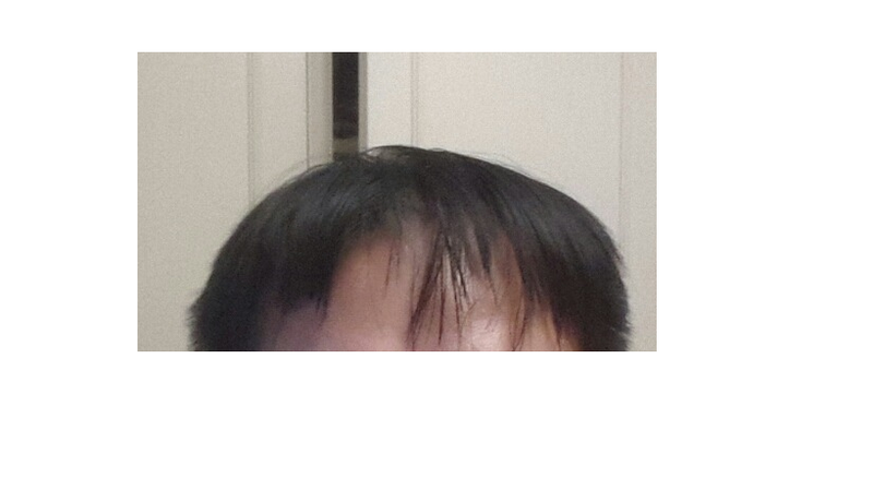 1.png