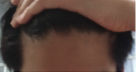 머리3(폰).png