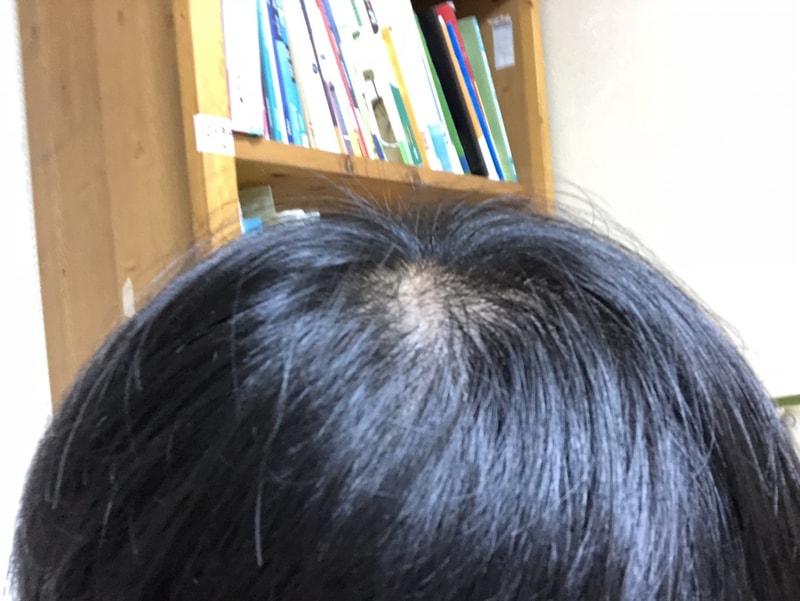 BB937296-7FC3-4CE2-9058-AF26BF533E8D.jpeg