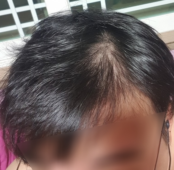 20180326_212807.jpg