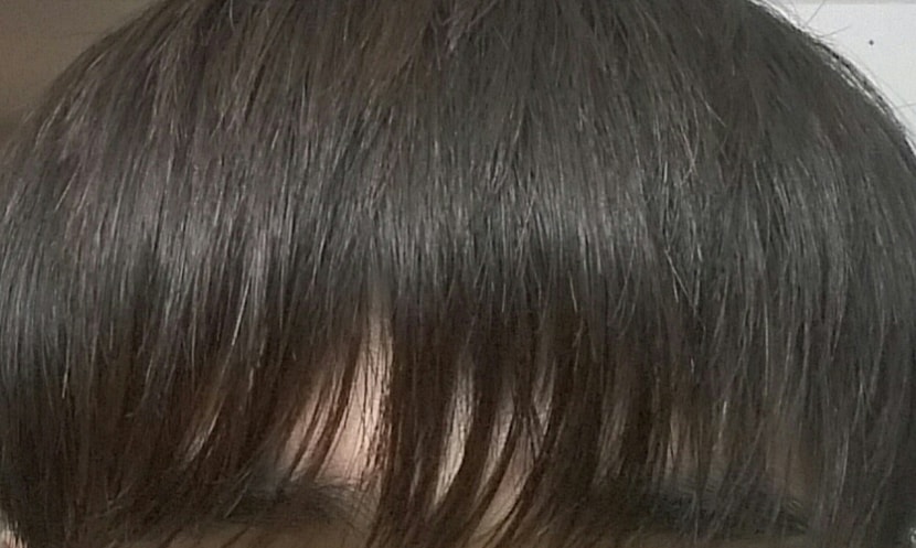 머리 앞으로 내렸을때