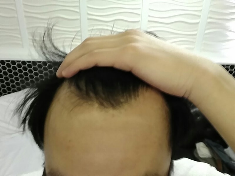 머리_20150124.jpg