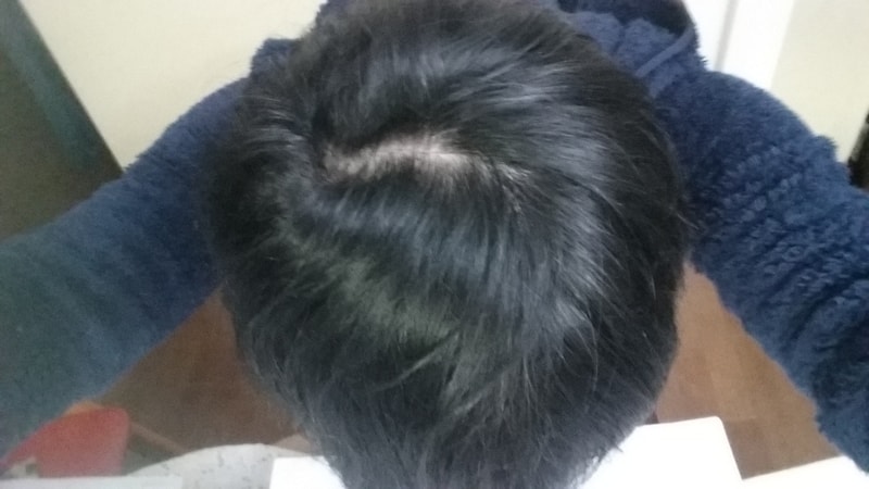 20161124_222105.jpg